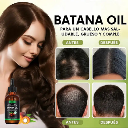 Aceite de Batana 100% Puro | Devuélvele la Vida a Tu Cabello 🍃